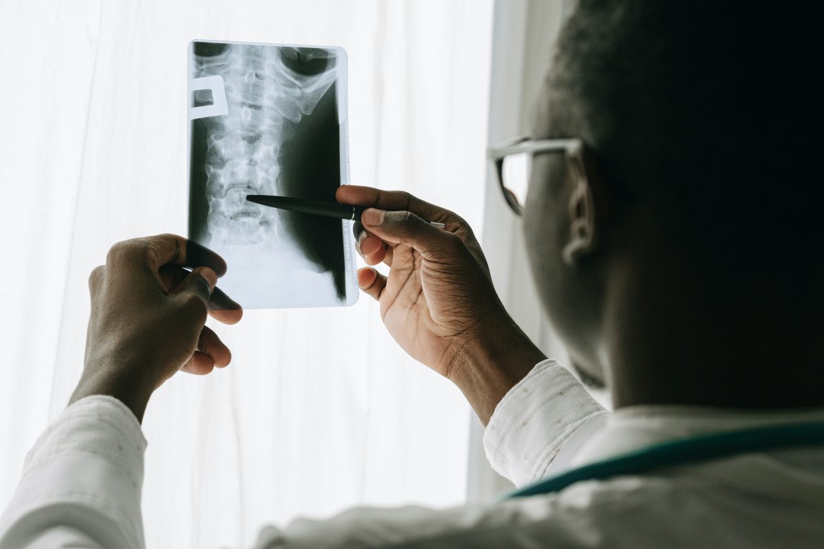 chiropractor looking at x-ray of spine