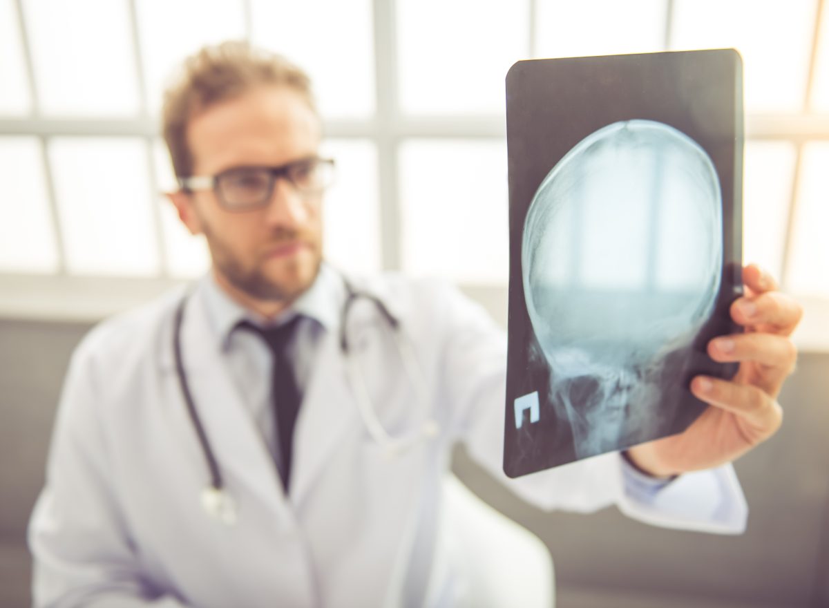 doctor looking at skull x-ray