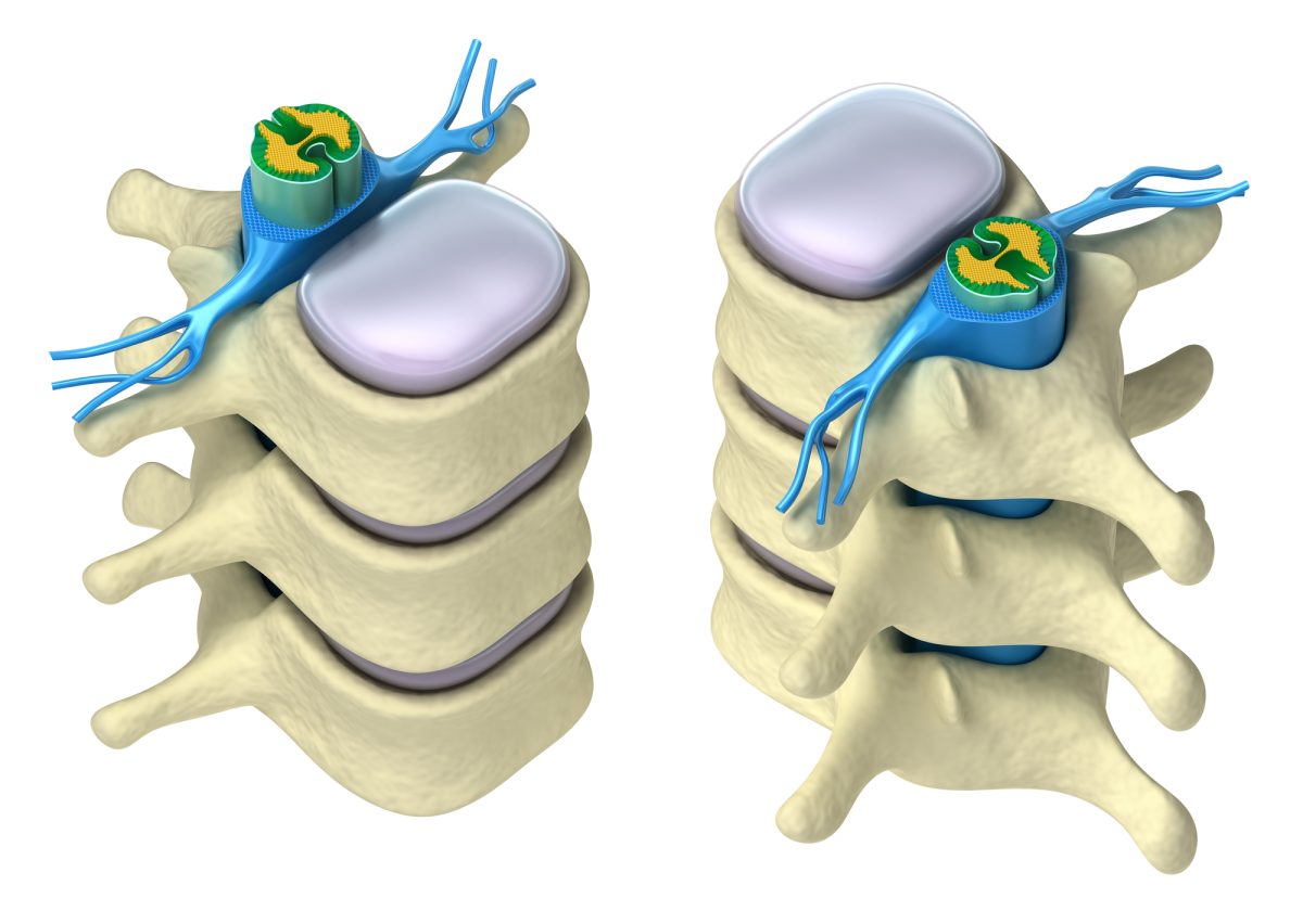 anatomy of the spine showing vertebrae and nerves
