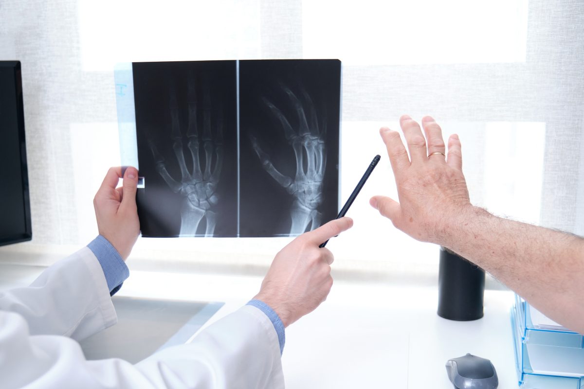 Doctor looking at x-ray of hand