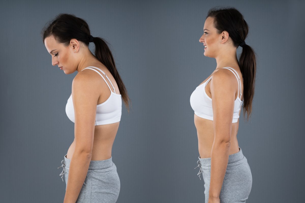 woman standing with bad posture on the left and good posture on the right
