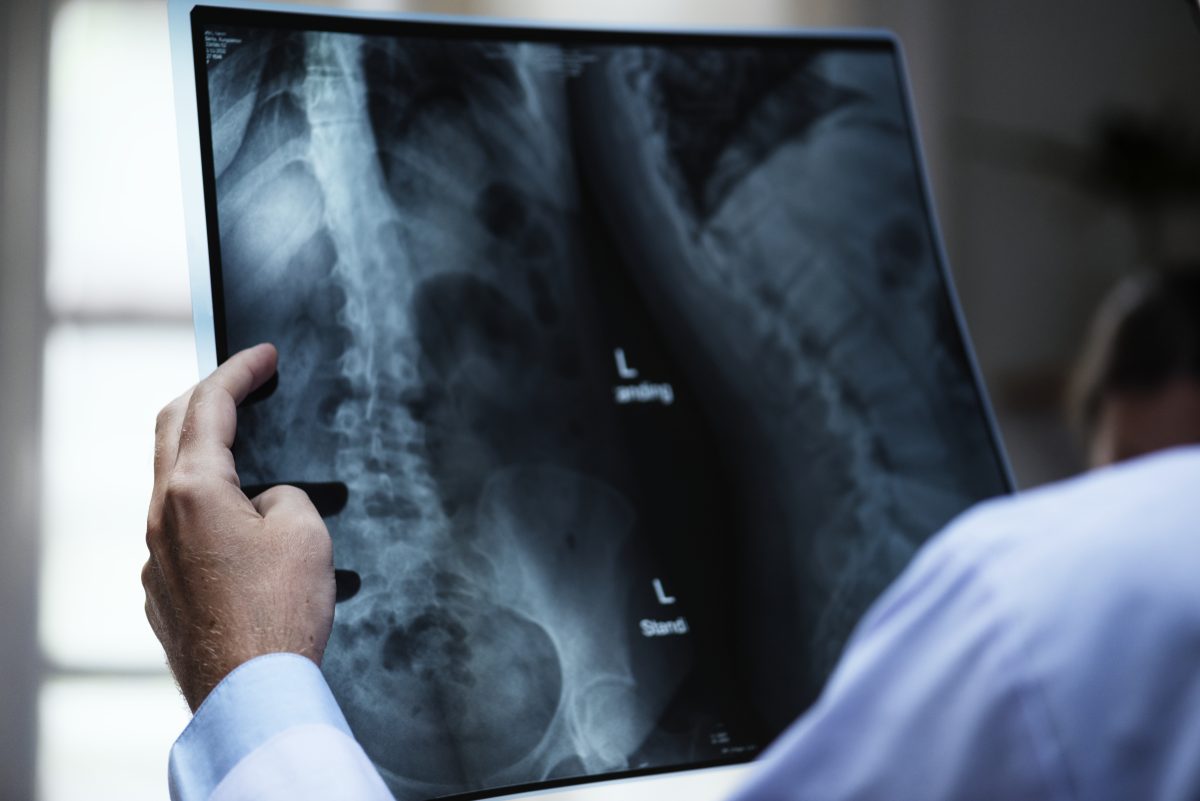 doctor examining lower back x-ray
